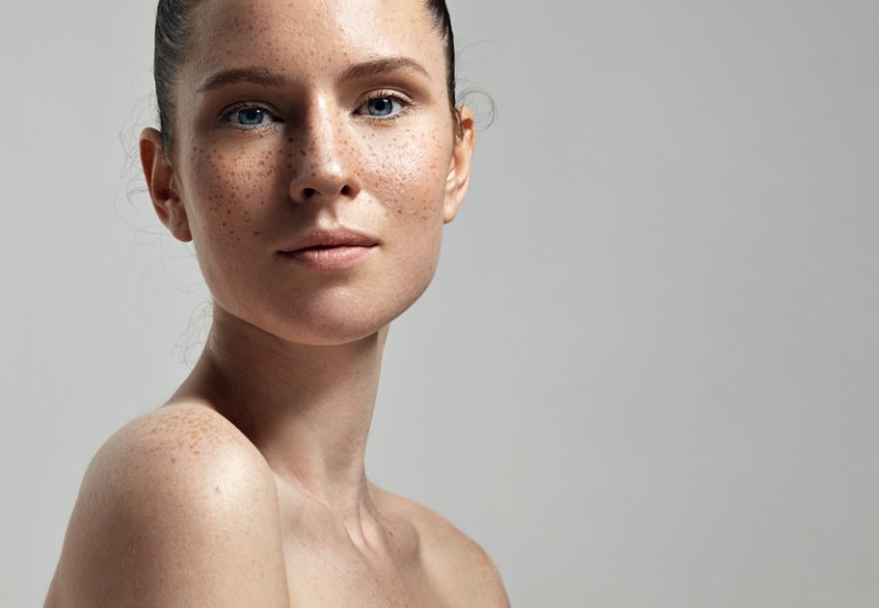 Pigment Treatment