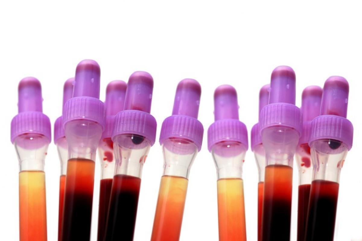 Blut-Labor (RAST)
